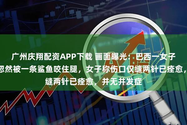 广州庆翔配资APP下载 画面曝光：巴西一女子正在潜水，忽然被一条鲨鱼咬住腿，女子称伤口仅缝两针已痊愈，并无并发症